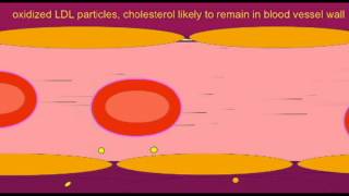 HEART DISEASE OXIDIZED LDL PARTICLES [upl. by Alberic]