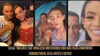 Casal maloka que viralizou mostrando vida nas ruas comemora sorriso novo veja antes e depois [upl. by Modestia]