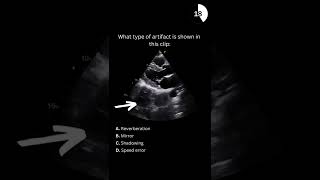 Echocardiography board practice question 28 [upl. by Fasa]