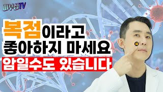 복점이라고 좋아하지 마세요  피부암일 수 있습니다 피부과 전문의 피부심 [upl. by Ashelman910]