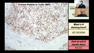 Immunohistochemistry in Pathology [upl. by Ydnam]