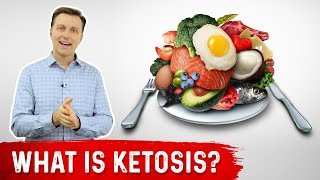 What is Ketosis  Dr Berg [upl. by Gussi691]