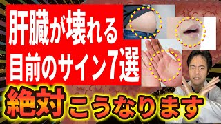 【放置厳禁！】知らないと本当に後悔する、肝臓が壊れる目前の危険なサイン7選！ [upl. by Narba197]