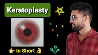 Keratoplasty lecture in opthalmology [upl. by Anuahsal]