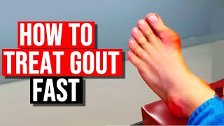 How To Treat Gout in 2024 [upl. by Nykal]