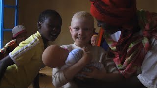 Albinos in Burundi Short Documentary [upl. by Artek]