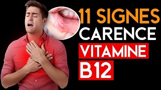 11 Signes et Symptômes les plus fréquents dune Carence en Vitamine B12 que VOUS DEVEZ Connaître [upl. by Vonnie]