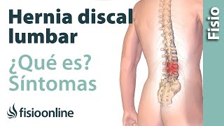 Hernia discal o de disco lumbar  Qué es causas síntomas y tratamiento [upl. by Dragoon612]