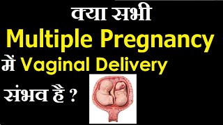 Management of the Multiple Pregnancy in Hindi  Nursing Lecture [upl. by Patricio]