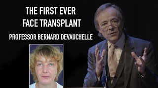 Professor Bernard Devauchelle amp Professor Sylvie Testelin  The first ever face transplant [upl. by Ennairda]