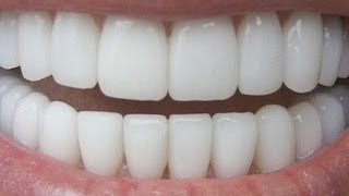 How To Have Natural White Teeth in 3 minutes  Works 100 [upl. by Buroker]