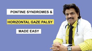 PONTINE SYNDROMES amp HORIZONTAL GAZE PALSY MADE EASY [upl. by Ayalahs]