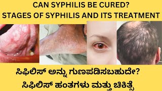 STAGES OF SYPHILISPENCILLIN INJECTION AND TABLETS FOR SYPHILIS FOLLOW UP AND COMPLICATIONS [upl. by Narcissus]