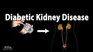 Diabetic Kidney Disease Animation [upl. by Raual]