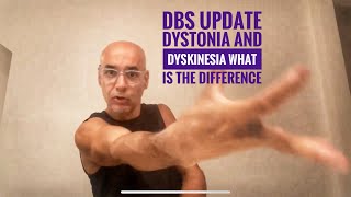 Dbs update dyskinesia and dystonia [upl. by Ytsirhk376]