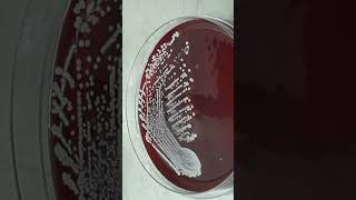 Growth Character of Staphylococcus hominis on Blood Agar Colony Morphology and Diagnostic Insights [upl. by Eiramoj]