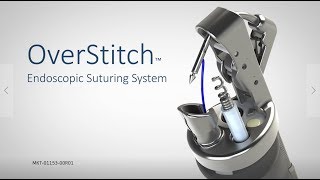 OverStitch™ Endoscopic Suturing System [upl. by Blakelee]