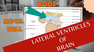 Boundaries of Lateral Ventricle of Brain  Anatomy of Lateral ventricles [upl. by Ettenahc]