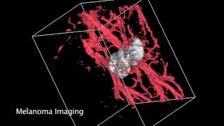 Photoacoustic Imaging BIMA2016 [upl. by Terrena]