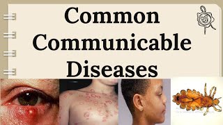 Health 4 Lesson 2 Quarter 2  Common Communicable Diseases  MelcBased [upl. by Leonid892]