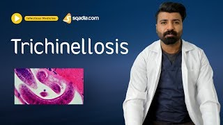 Trichinellosis  Infectious Disease Video Lectures  Medical Education  VLearning [upl. by Solegnave689]