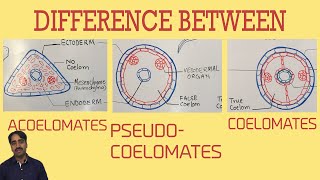 Acoelomates Pseudocoelomates and coelomates  Triploblastic organisation [upl. by Marilin]