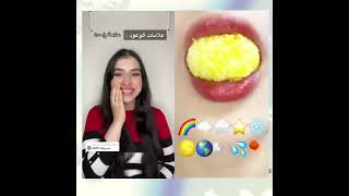 تجميع قصص اسراء نبيل  قصص اكسبلور اسراءنبيل قصصواقعية قصصي shorts foryou ffyp tiktok t [upl. by Dorkas]