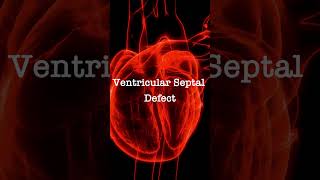 Normal Heart Sounds vs Ventricular Septal Defect Murmur [upl. by Aiuqenehs]