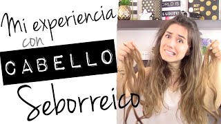 Mi experiencia con SEBORREA en el CABELLO [upl. by Carling]