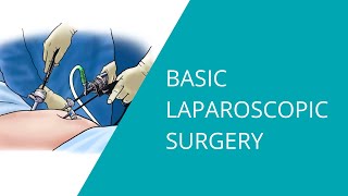 Basic Laparoscopic Surgery [upl. by Aydan647]