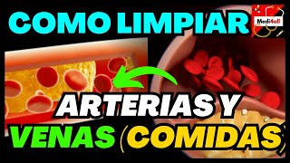 Como LIMPIAR tus ARTERIAS y Venas Comidas y Arterioesclerosis [upl. by Ocirled631]