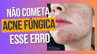 Escolhendo o melhor tratamento para acne fúngica  Comparação Peróxido de Benzoíla e Ácido Azelaico [upl. by Avrom]