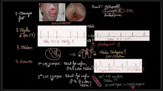 Traitement de lhypertension artérielle  Guidelines  Exercices  HTA  Docteur Synapse [upl. by Assennej]