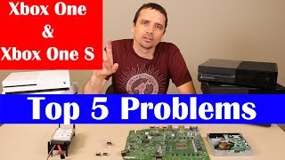 Xbox One Top 5 Problems [upl. by Fabiola]