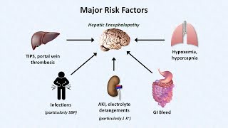 Hepatic Encephalopathy [upl. by Ragse69]