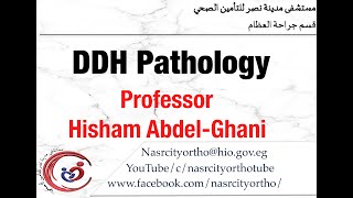 DDH Pathology ProfHisham AbdelGhani nasrcity covid19 online lectures 2020 [upl. by Nimzay]