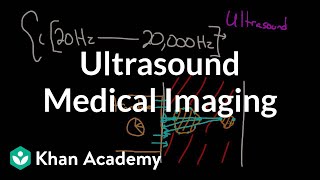 Ultrasound medical imaging  Mechanical waves and sound  Physics  Khan Academy [upl. by Einhoj210]