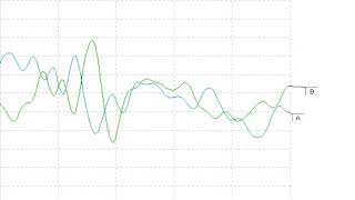 Cochlear Microphonic [upl. by Ardnauqal]