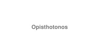 How to Pronounce quotOpisthotonosquot [upl. by Nehcterg]