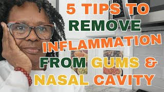 How I Healed My Inflamed Gums amp Toothache Over the Weekend Without Seeing a Dentist [upl. by Eityak]