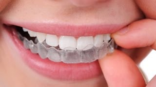 Ortodoncia invisible Inicia INVISALIGN [upl. by Ortiz993]