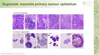 Investigating colorectal cancer using epithelial organoid cultures [upl. by Earissed]