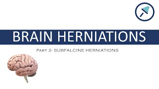 BRAIN HERNIATIONS 24 Subfalcine Herniations [upl. by Regnig]