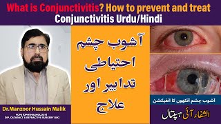 Viral conjunctivitis treatment  How to cure pink eye at home fast  Urdu Hindi [upl. by Adnalor]