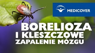 Borelioza i kleszczowe zapalenie mózgu [upl. by Mercorr]