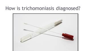 Trichomoniasis [upl. by Hilel]