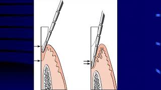 Fall 2020  Periodontology 1  Lec 1  Histology of the periodontium [upl. by Sucramaj407]