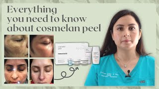 COSMELAN PEEL  SENIOR PRACTITIONERS GUIDE TO Hyperpigmentation treatment [upl. by Stretch]