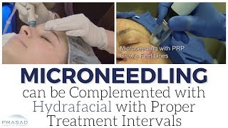 How Microneedling with PRP and HydraFacial Work Well Together by Spacing and Alternating Treatments [upl. by Gannon]