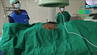 Splanchnic Nerve Radiofrequency ablation for cancer pain painclinicMayiladuthurai [upl. by Lacombe628]